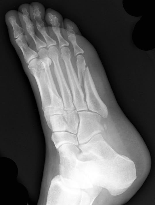 Orthopaedic Knowledge Ankle and Foot X Ray